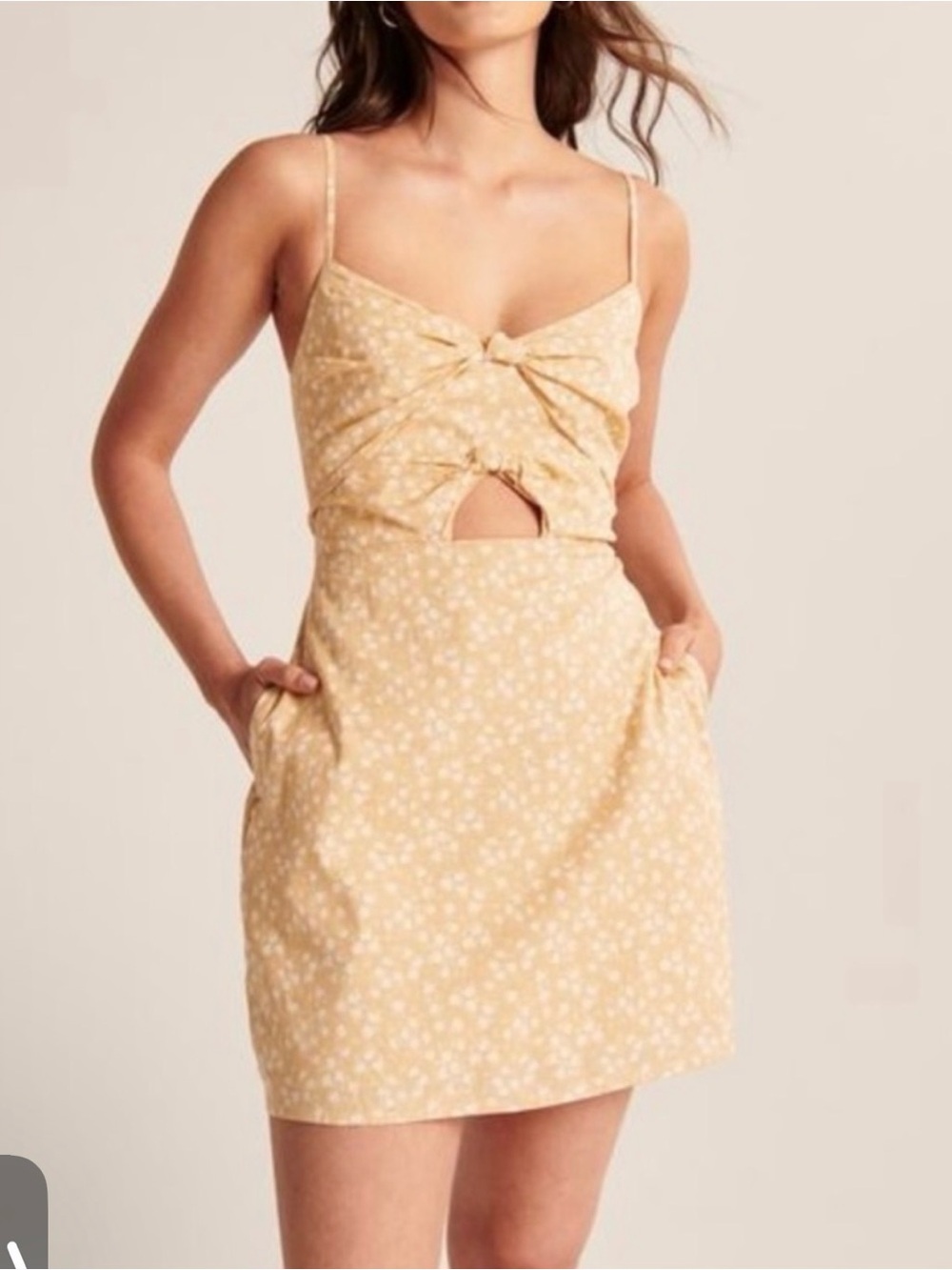 Abercrombie & Fitch Yellow Floral Tie-Front Mini Dress